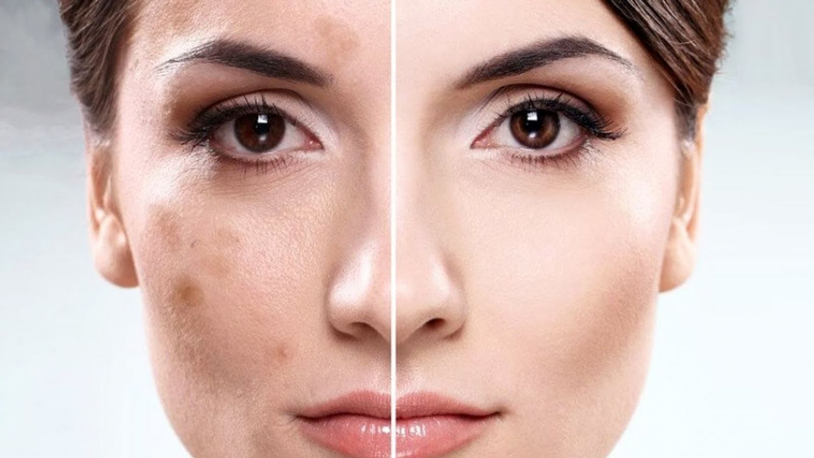Tratarea pigmentării și rejuvenarea pielii